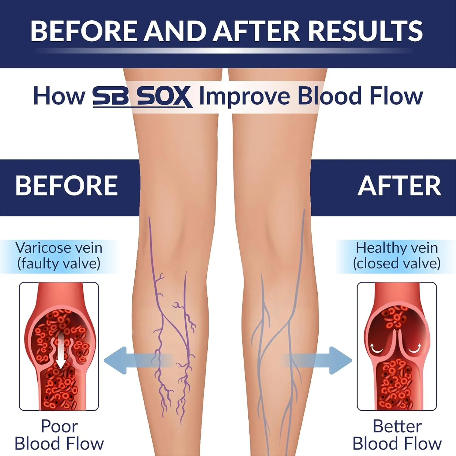 SB SOX 3-Pair Compression Socks for Women & Men (15-20mmHg)  Womens Compression Socks All Day Wear!